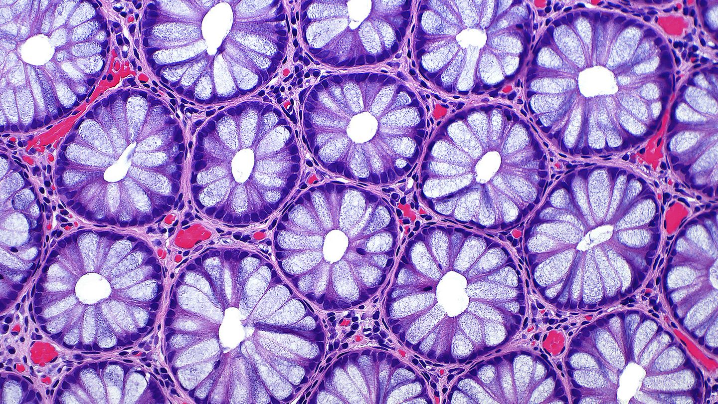 15th Place    Dr. Ziad El-Zaatari    Houston Methodist Hospital    Department of Pathology and Genomic Medicine    Houston, Texas, USA    Cross sections of normal human colon epithelial crypts    Brightfield    20X (Objective Lens Magnification)