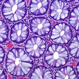 15th Place    Dr. Ziad El-Zaatari    Houston Methodist Hospital    Department of Pathology and Genomic Medicine    Houston, Texas, USA    Cross sections of normal human colon epithelial crypts    Brightfield    20X (Objective Lens Magnification)