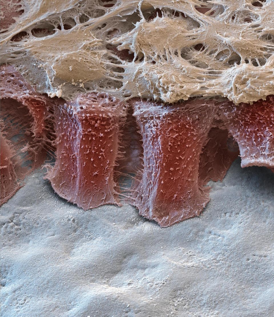 Zähne: Auf einem embryonalen Zahn (weiß) zeigen sich Ameloblasten (rot). Sie sind Säulen, in Form und Funktion, denn diese Zellen bauen den Zahnschmelz auf. Allerdings nur zweimal im Leben: bei den Milch- und den bleibenden Zähnen. Die Zellen verkürzen sich, je größer der Zahn wird, und verschwinden, bevor er durchs Zahnfleisch bricht. Der Schmelz verändert sich dann zeitlebens nicht mehr wesentlich. Und kitten kann ihn nur der Arzt Auf einem embryonalen Zahn (weiß) zeigen sich Ameloblasten (rot). Sie sind Säulen, in Form und Funktion, denn diese Zellen bauen den Zahnschmelz auf. Allerdings nur zweimal im Leben: bei den Milch- und den bleibenden Zähnen. Die Zellen verkürzen sich, je größer der Zahn wird, und verschwinden, bevor er durchs Zahnfleisch bricht. Der Schmelz verändert sich dann zeitlebens nicht mehr wesentlich. Und kitten kann ihn nur der Arzt