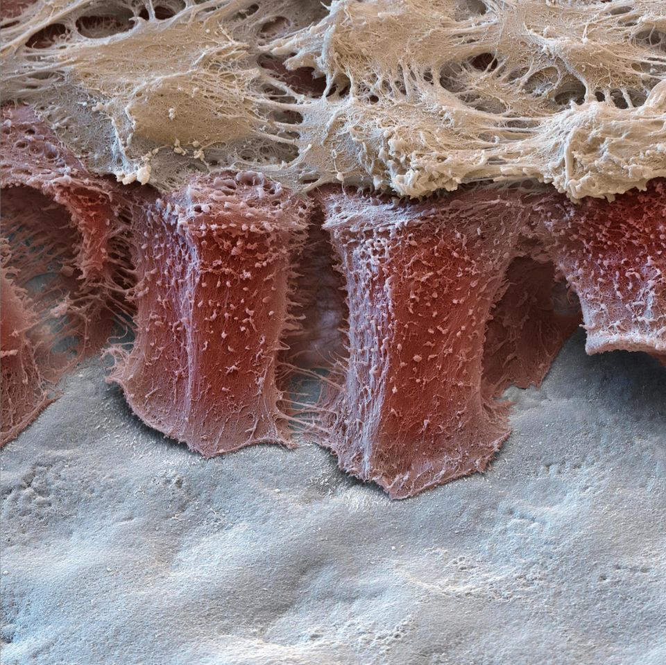 Auf einem embryonalen Zahn (weiß) zeigen sich Ameloblasten (rot). Sie sind Säulen, in Form und Funktion, denn diese Zellen bauen den Zahnschmelz auf. Allerdings nur zweimal im Leben: bei den Milch- und den bleibenden Zähnen. Die Zellen verkürzen sich, je größer der Zahn wird, und verschwinden, bevor er durchs Zahnfleisch bricht. Der Schmelz verändert sich dann zeitlebens nicht mehr wesentlich. Und kitten kann ihn nur der Arzt