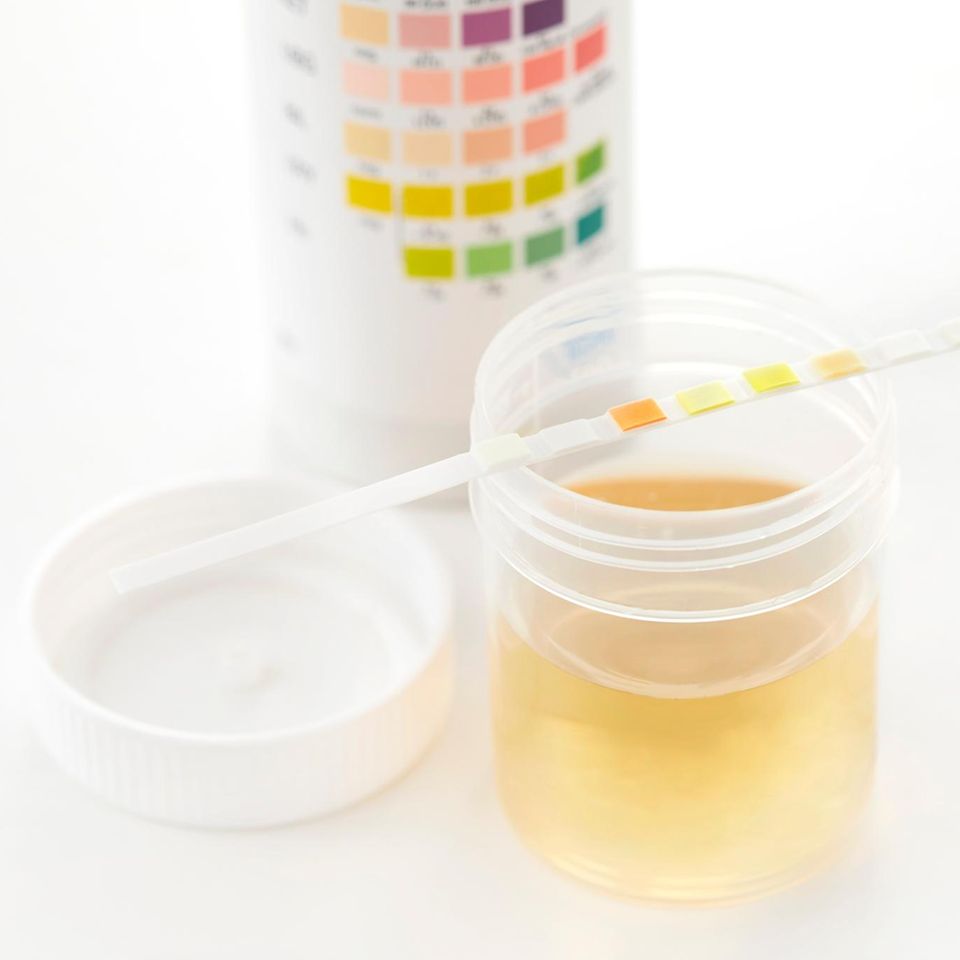 Was Menschen ausscheiden, gibt der Forschung Einblick ihn ihre Körper: Die Felder des Teststreifens verfärben sich je nach Konzentration einer Substanz im Urin. Gemessen werden etwa Glukose und Nitrit