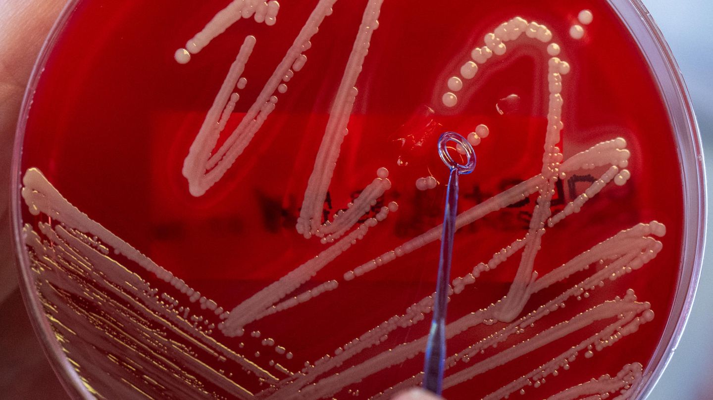 Gebrauchskulturen des Bakteriums Staphylococcus aureus