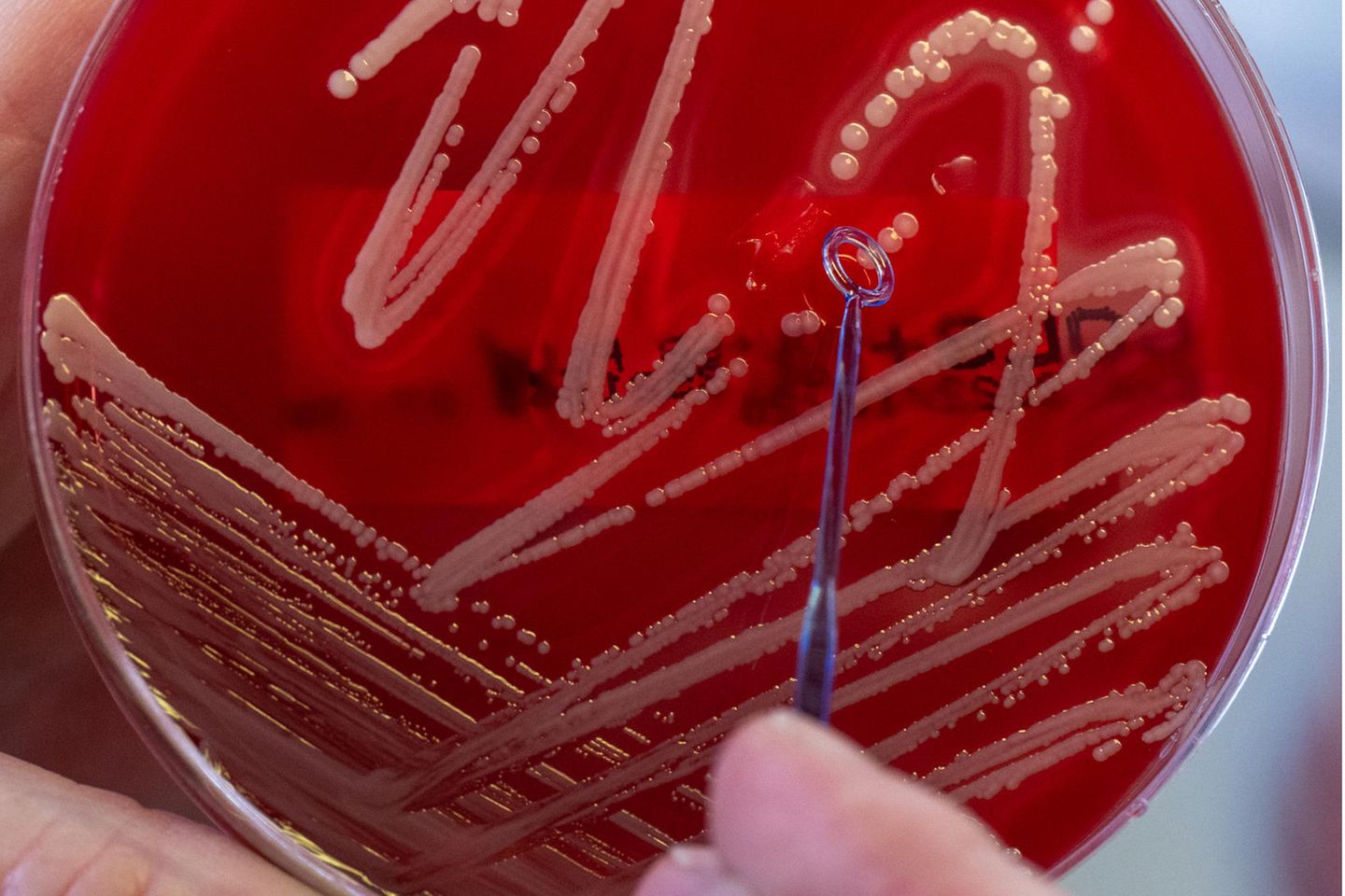 Gebrauchskulturen des Bakteriums Staphylococcus aureus