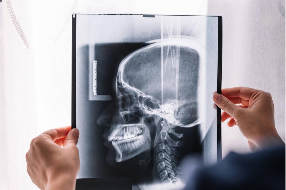 Ein Arzt schaut sich ein Röntgenbild eines Gehirns an