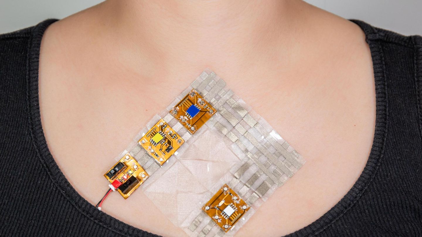 Mehr als Zierde? : Das "Skinkit" soll Rechenleistung auf die Haut bringen und so beispielsweise tragbare Lichtsensoren für Sehbehinderte ansteuern. Die Teile greifen wie Puzzlestücke ineinander Das "Skinkit" soll Rechenleistung auf die Haut bringen und so beispielsweise tragbare Lichtsensoren für Sehbehinderte ansteuern. Die Teile greifen wie Puzzlestücke ineinander