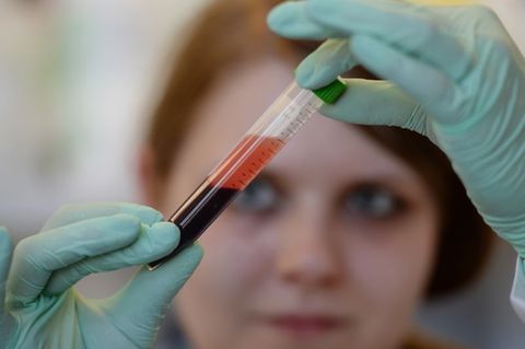 Röhrchen mit Blut in den Händen einer Frau im Labor