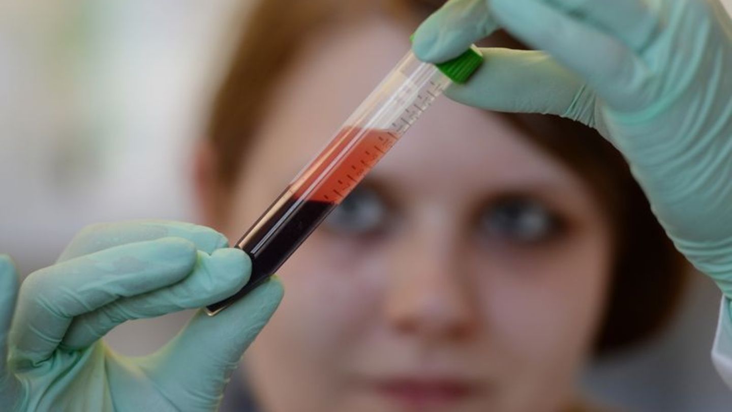 Röhrchen mit Blut in den Händen einer Frau im Labor