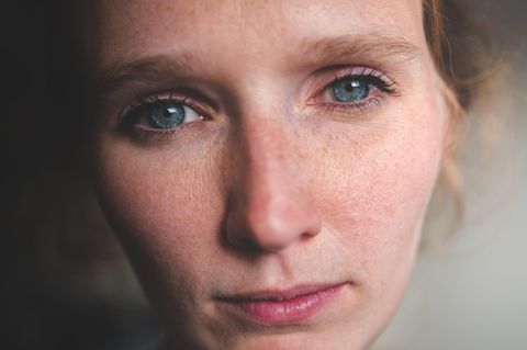 Frau schaut müde in die Kamera, Schlafmangel-Symptome