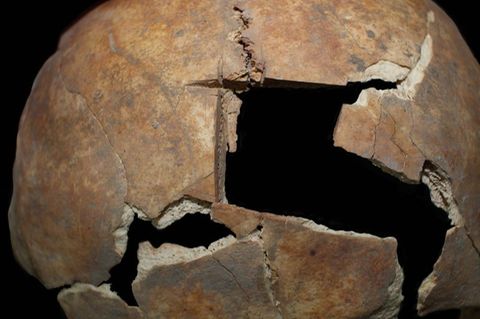 Diese Nahaufnahme zeigt den Schädel mit der Trepanation. Foto: Rachel Kalisher/dpa