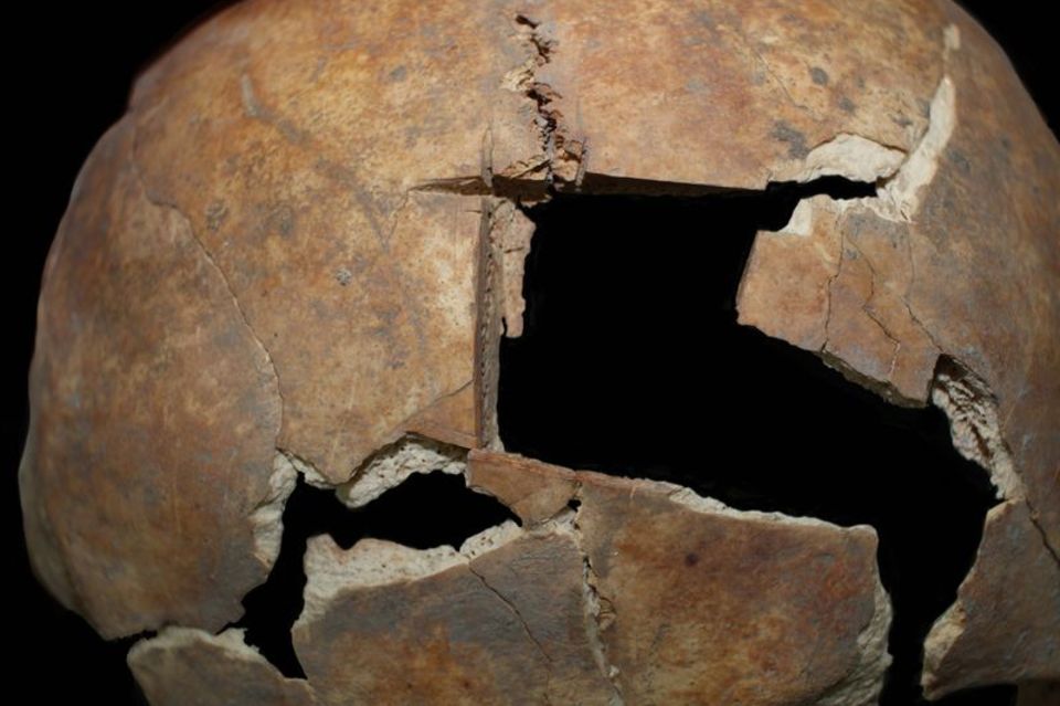 Diese Nahaufnahme zeigt den Schädel mit der Trepanation