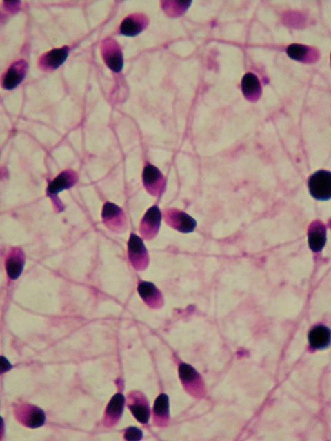 Menschliches Sperma vergrößert