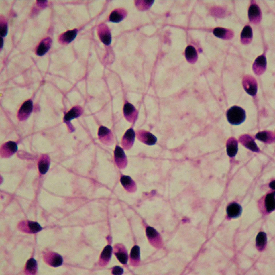 Menschliches Sperma vergrößert Menschliches Sperma vergrößert