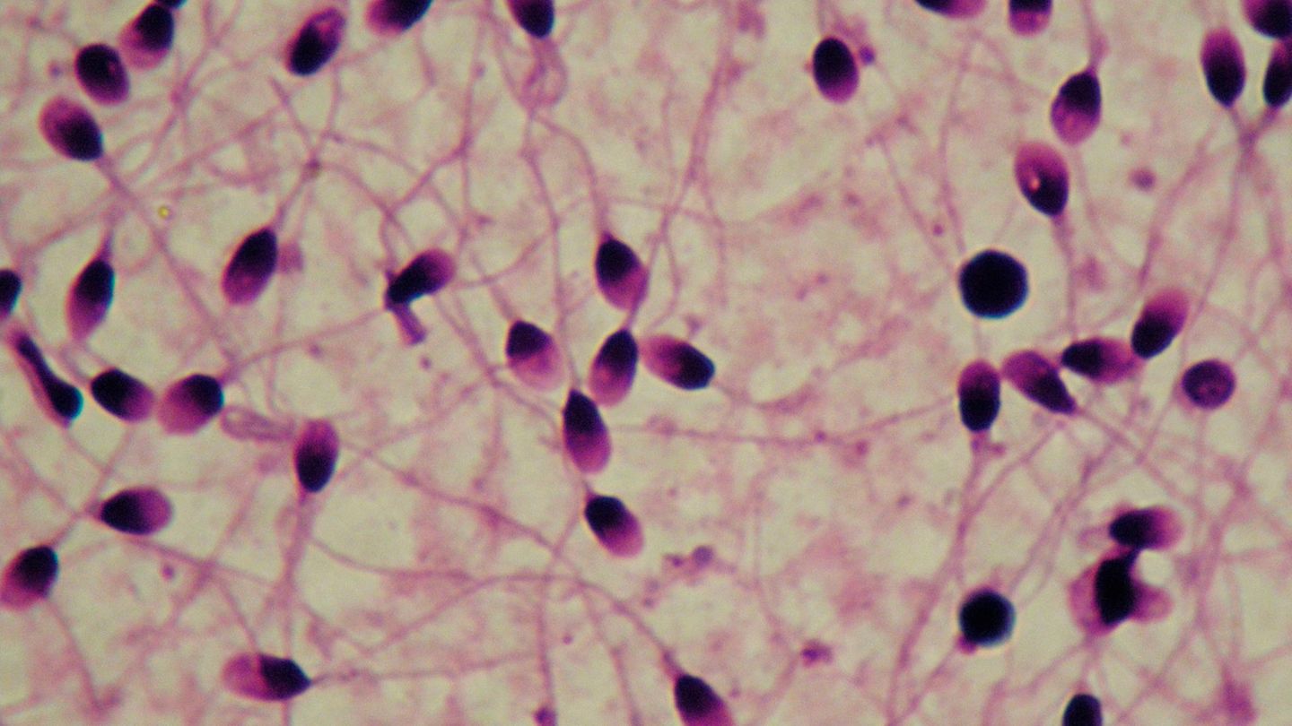 Menschliches Sperma vergrößert