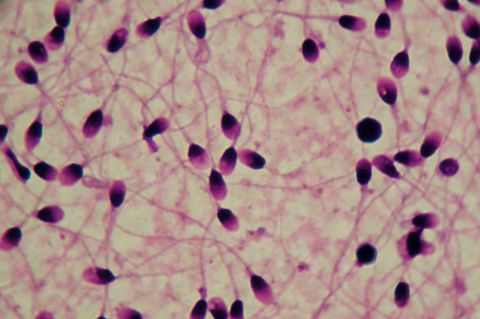 Menschliches Sperma vergrößert