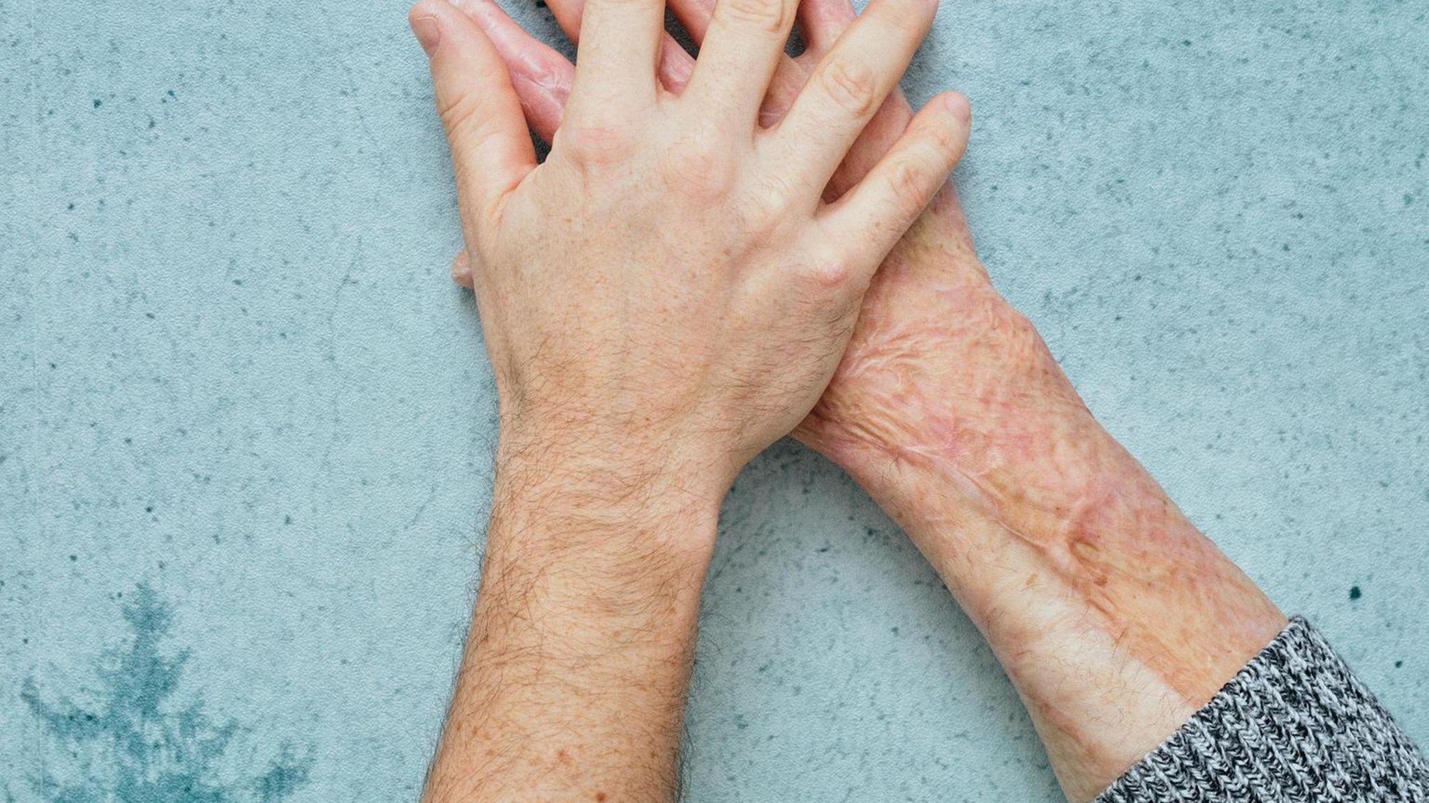 Ein Mann fängt Feuer, 95 Prozent seiner Haut verbrennen. Ein Todesurteil, normalerweise. Dann erfährt ein Arzt, dass der Mann einen Zwillingsbruder hat. Sie teilen dieselben Freunde und Hobbys, dieselben Gene. Kann der eine in die Haut des anderen schlüpfen?