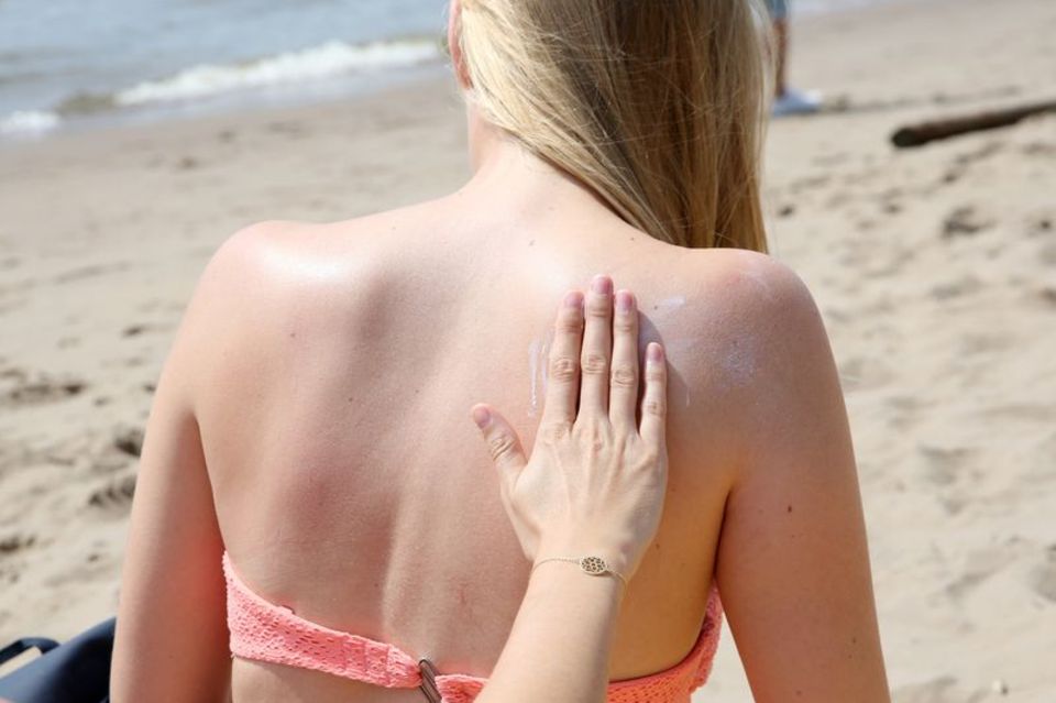 Eine Frau am Strand wird am Rücken eingecremt