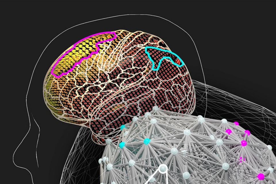 Illustration eines Virtuellen Gehirns. Sogenannte Knoten simulieren Schaltkreise, die bei Denkprozessen verschiedene Aufgaben übernehmen