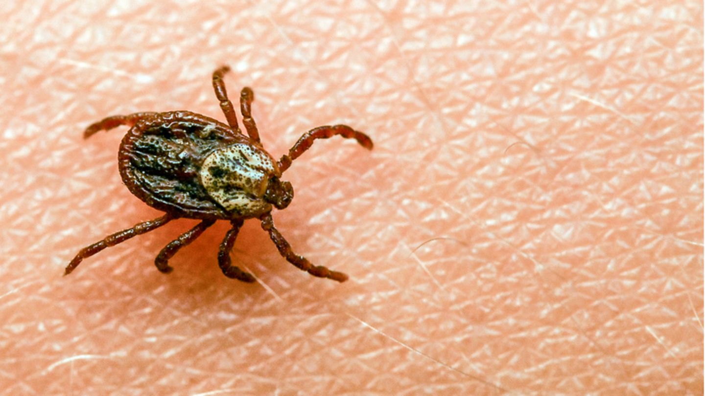 Zecken können Erreger verschiedener Krankheiten wie Borreliose und FSME übertragen