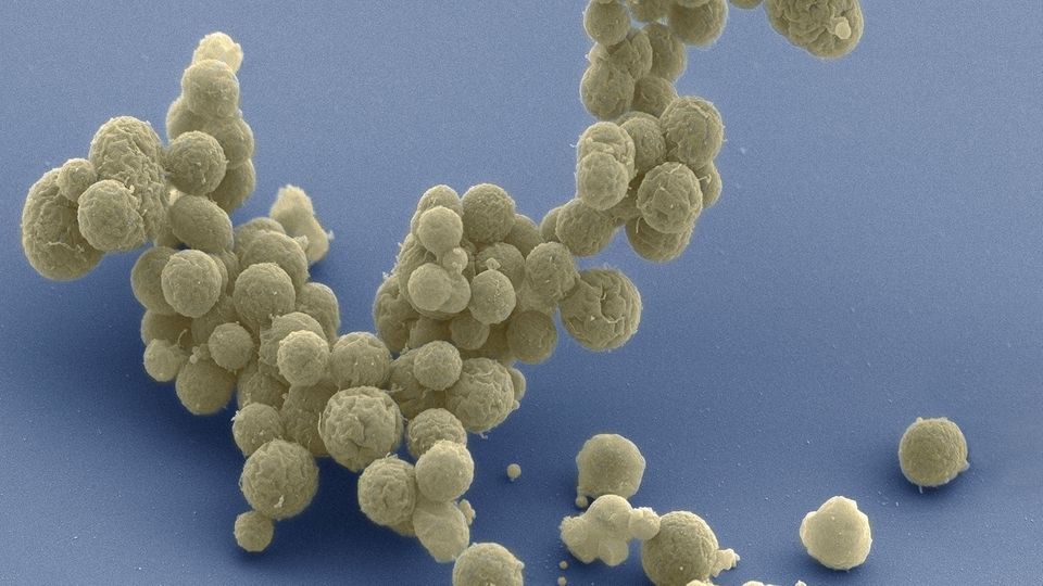 Evolution : Erst im Elektronenmikroskop werden die winzigen Zellen des Bakteriums Mycoplasma mycoides bei 15 000-facher Vergrößerung sichtbar Erst im Elektronenmikroskop werden die winzigen Zellen des Bakteriums Mycoplasma mycoides bei 15 000-facher Vergrößerung sichtbar
