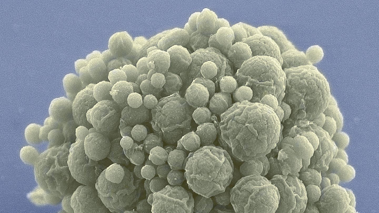 Viele Zellen des Bakteriums Mycoplasma mycoides haben sich zu einer Kugel zusammengeballt. Forschende haben sein Erbgut auf ein Minimum von weniger als 500 Genen gestrafft – und trotzdem konnte das Bakterium im Labor nicht nur überleben, sondern sich sogar weiterentwickeln