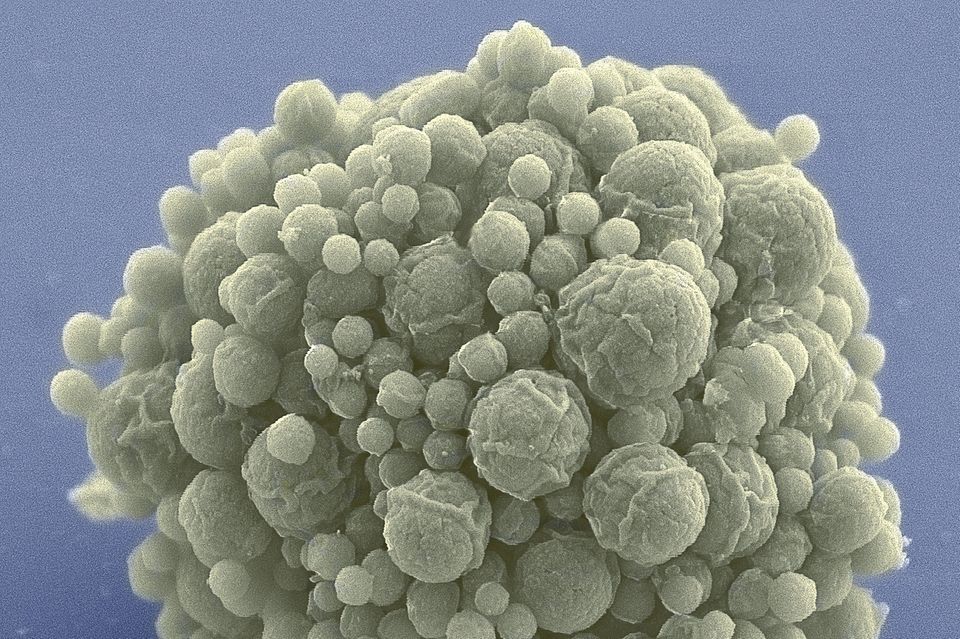 Viele Zellen des Bakteriums Mycoplasma mycoides haben sich zu einer Kugel zusammengeballt. Forschende haben sein Erbgut auf ein Minimum von weniger als 500 Genen gestrafft – und trotzdem konnte das Bakterium im Labor nicht nur überleben, sondern sich sogar weiterentwickeln
