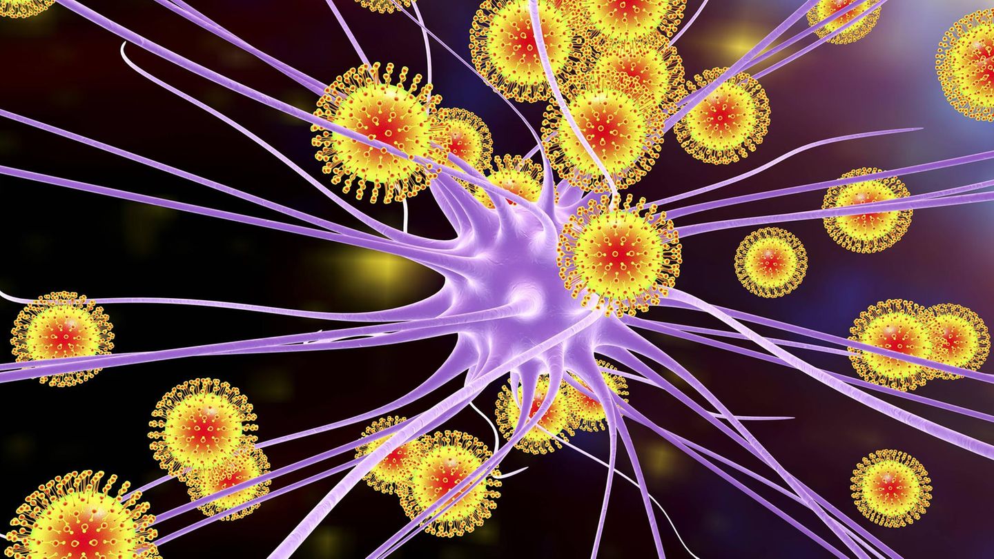 Guillain-Barré-Syndrom Guillain-Barré-Syndrom