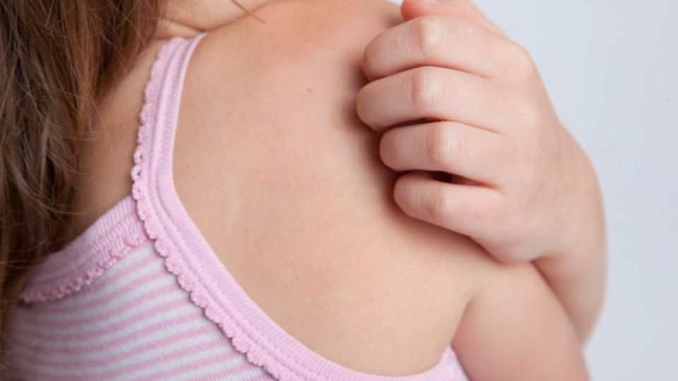 Wespenstich beim Kind Wespenstich beim Kind