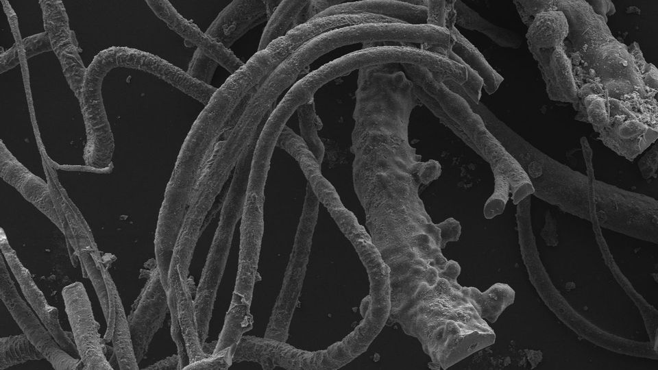 Evolution: Die fadenartigen Strukuren sind teilweise mit bloßem Auge zu erkennen Die fadenartigen Strukuren sind teilweise mit bloßem Auge zu erkennen