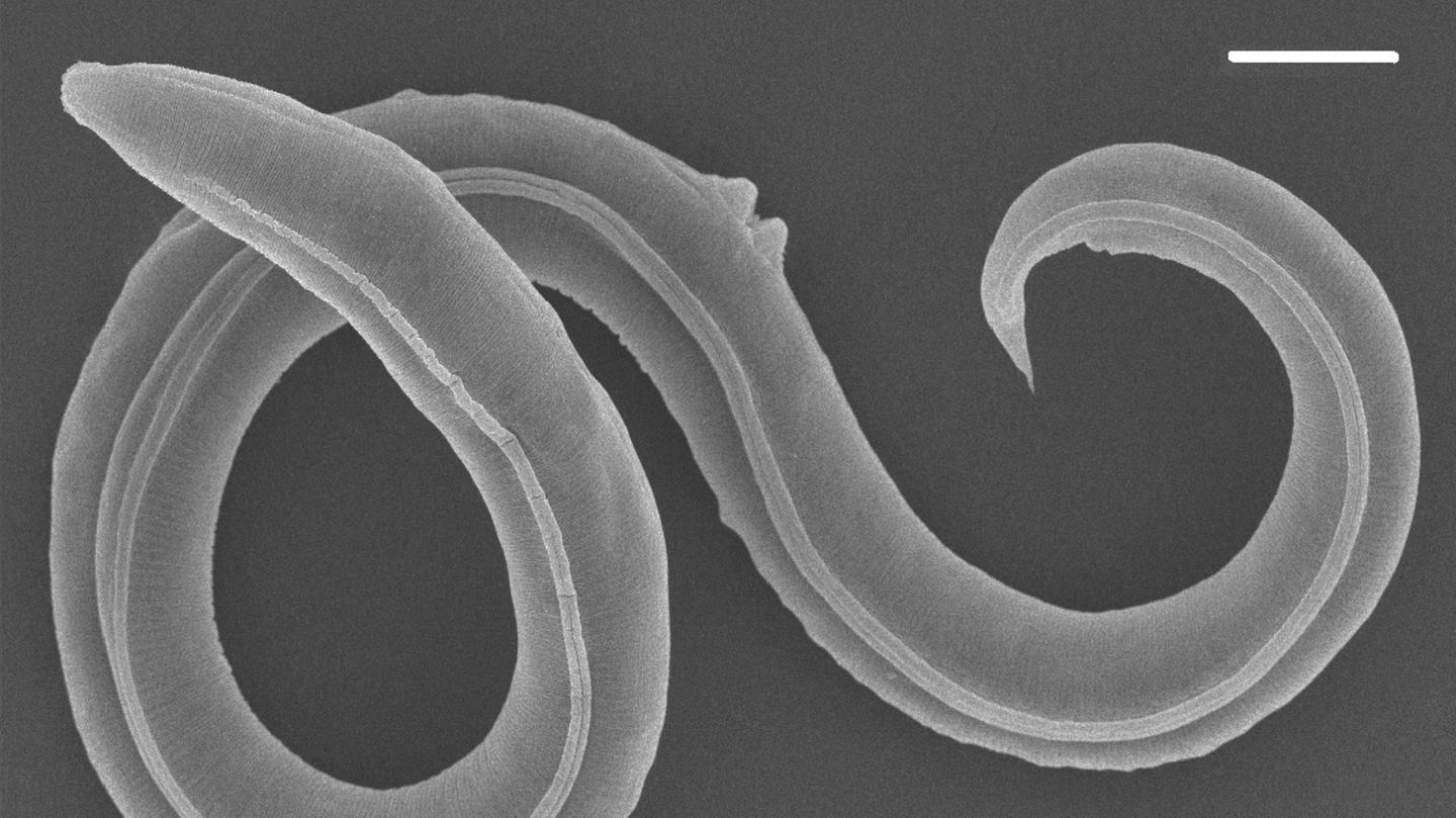 Wiederbelebter Fadenwurm aus dem Permafrost Sibiriens (Maßstabsbalken = 20 Mikrometer)