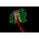 Farbenfrohes Edelweiß