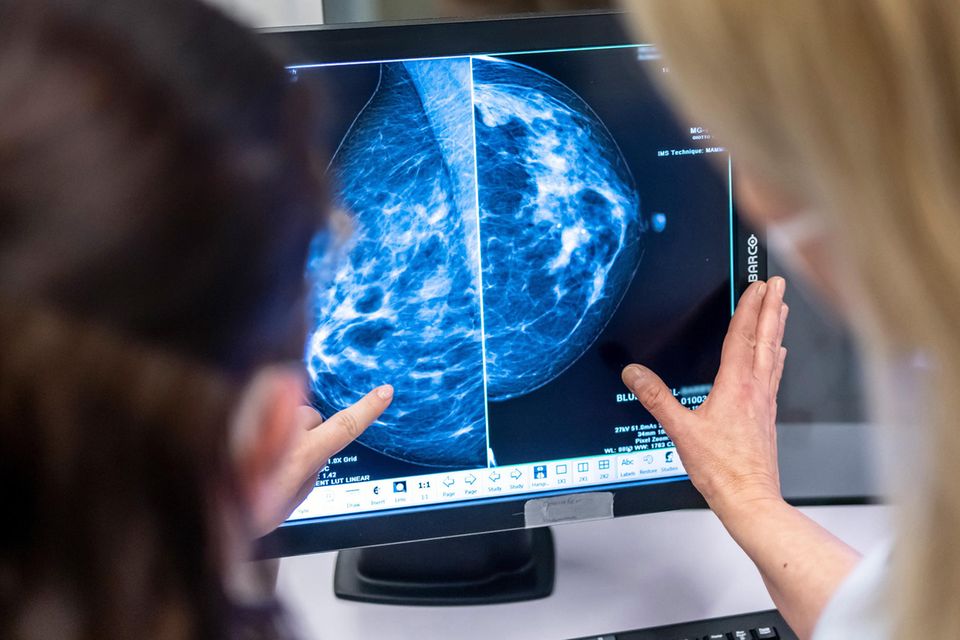 Medizinisches Personal untersucht per Mammographie die Brust einer Patientin auf Brustkrebs