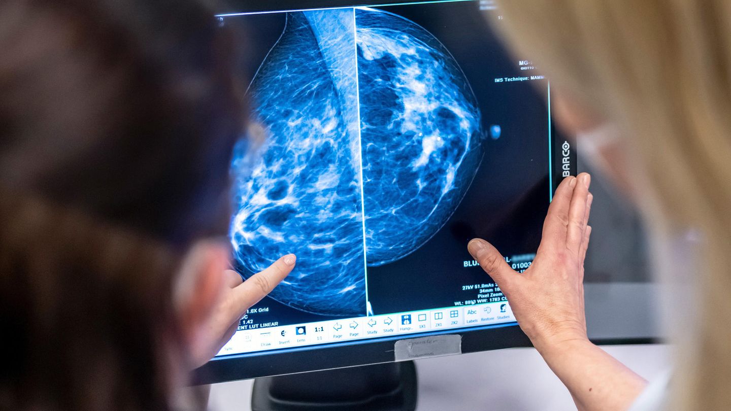 Medizinisches Personal untersucht per Mammographie die Brust einer Patientin auf Brustkrebs