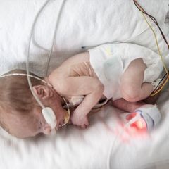 625 Gramm leicht kam Jasper auf die Welt. Extrem früh, in der 23. Schwangerschaftswoche geboren, war seine erste Lebensstation der Inkubator des Southmead Hospital in Bristol. Und seine Rettung