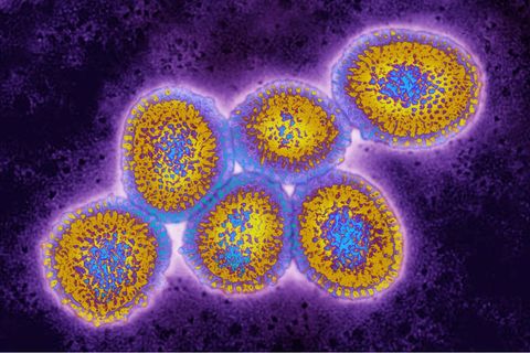 Elektronenmikroskop-Aufnahme des Vogelgrippevirus H5N1