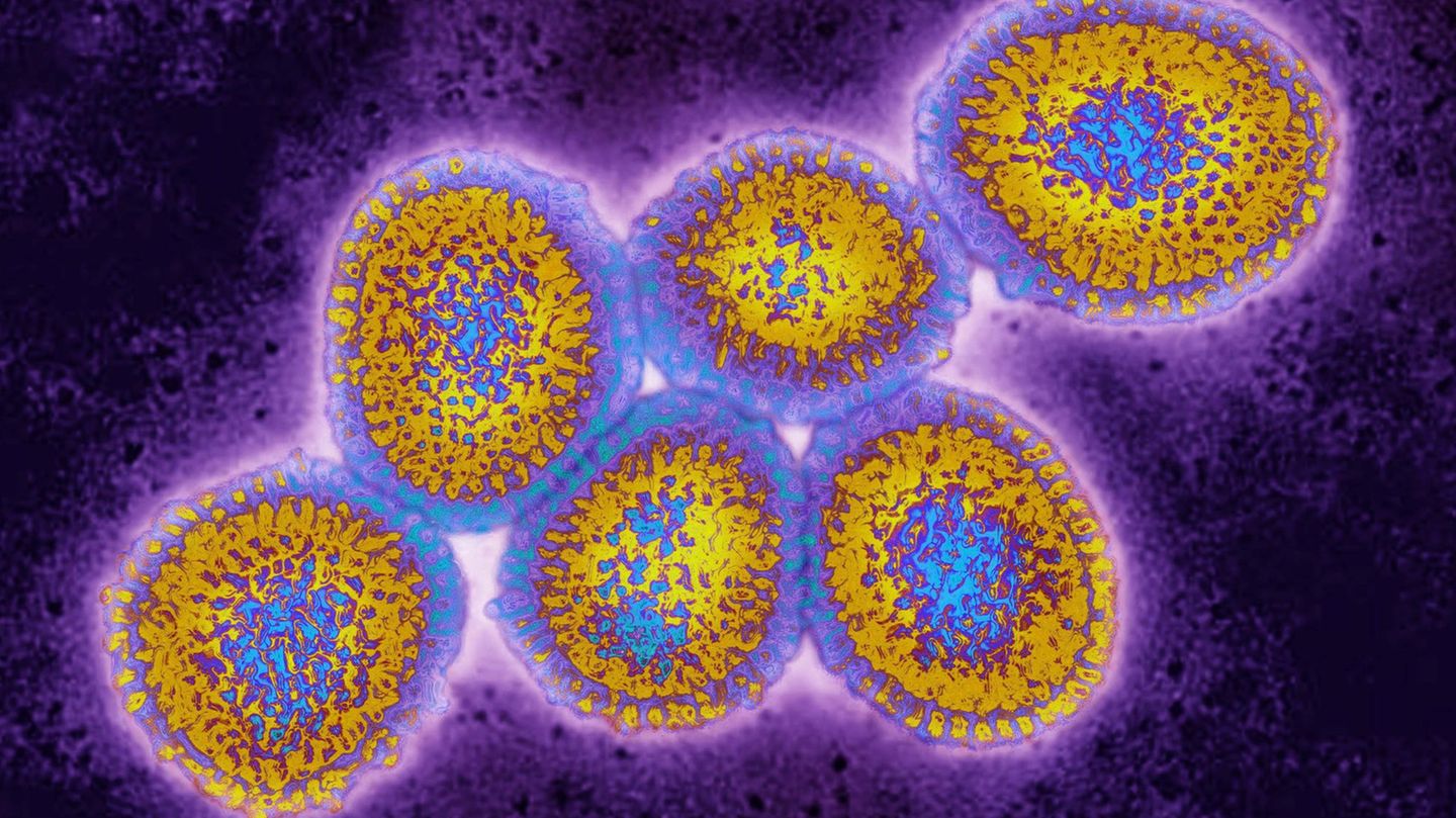 Elektronenmikroskop-Aufnahme des Vogelgrippevirus H5N1
