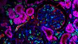 Mikroskopaufnahme genetisch veränderter Nierenzellen eines Schweins