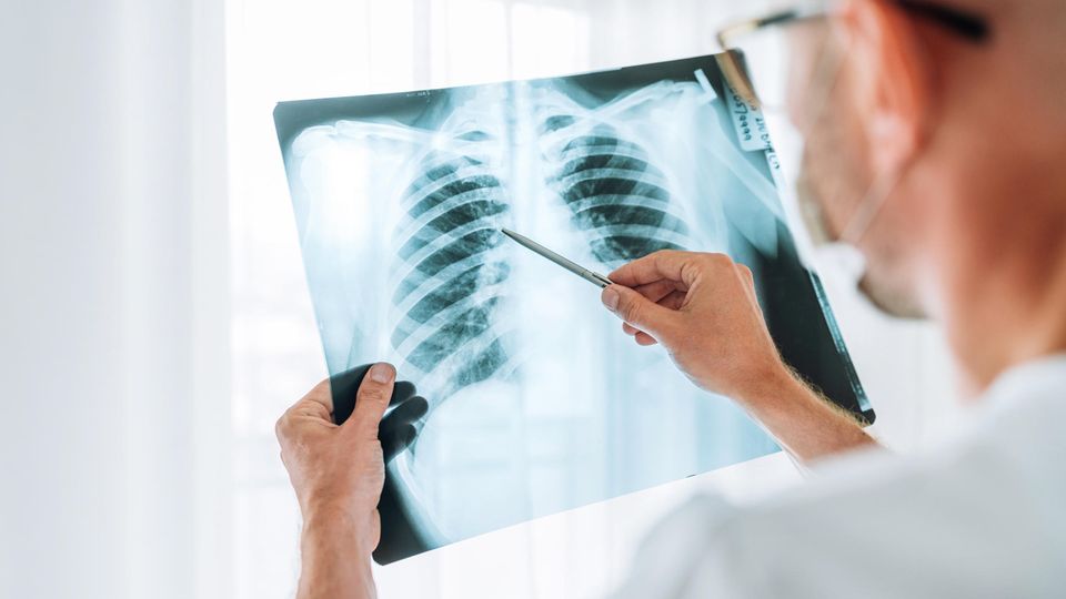 Bei der Analyse von Röntgenbildern können sich Ärzte von Künstlicher Intelligenz helfen lassen