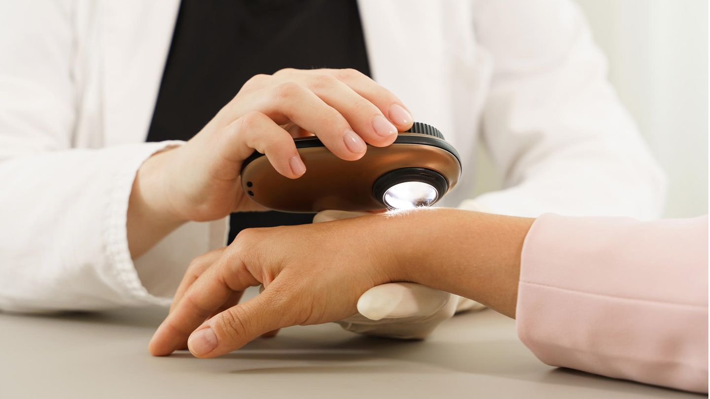 Als Ergänzung zur ärztlichen Begutachtung von Hautveränderungen wird KI in der Dermatologie bereits seit längerem eingesetzt 