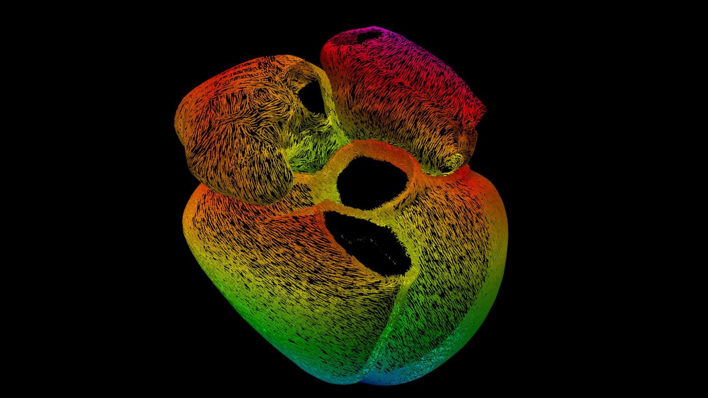 Computersimulation der Muskelzellen, die menschliche Herzwände bilden