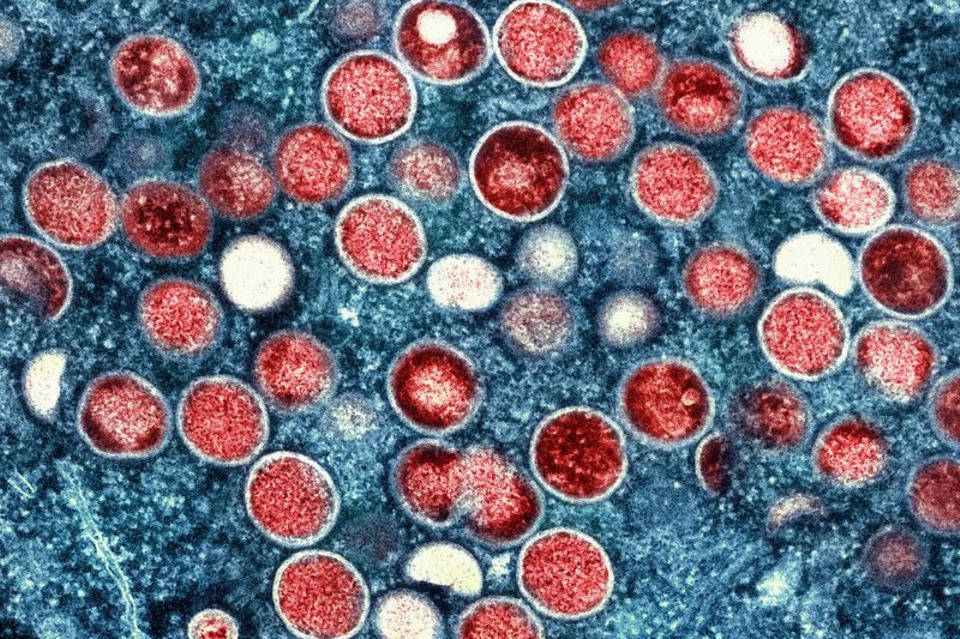 Mpox-Viren unter dem Mikroskop