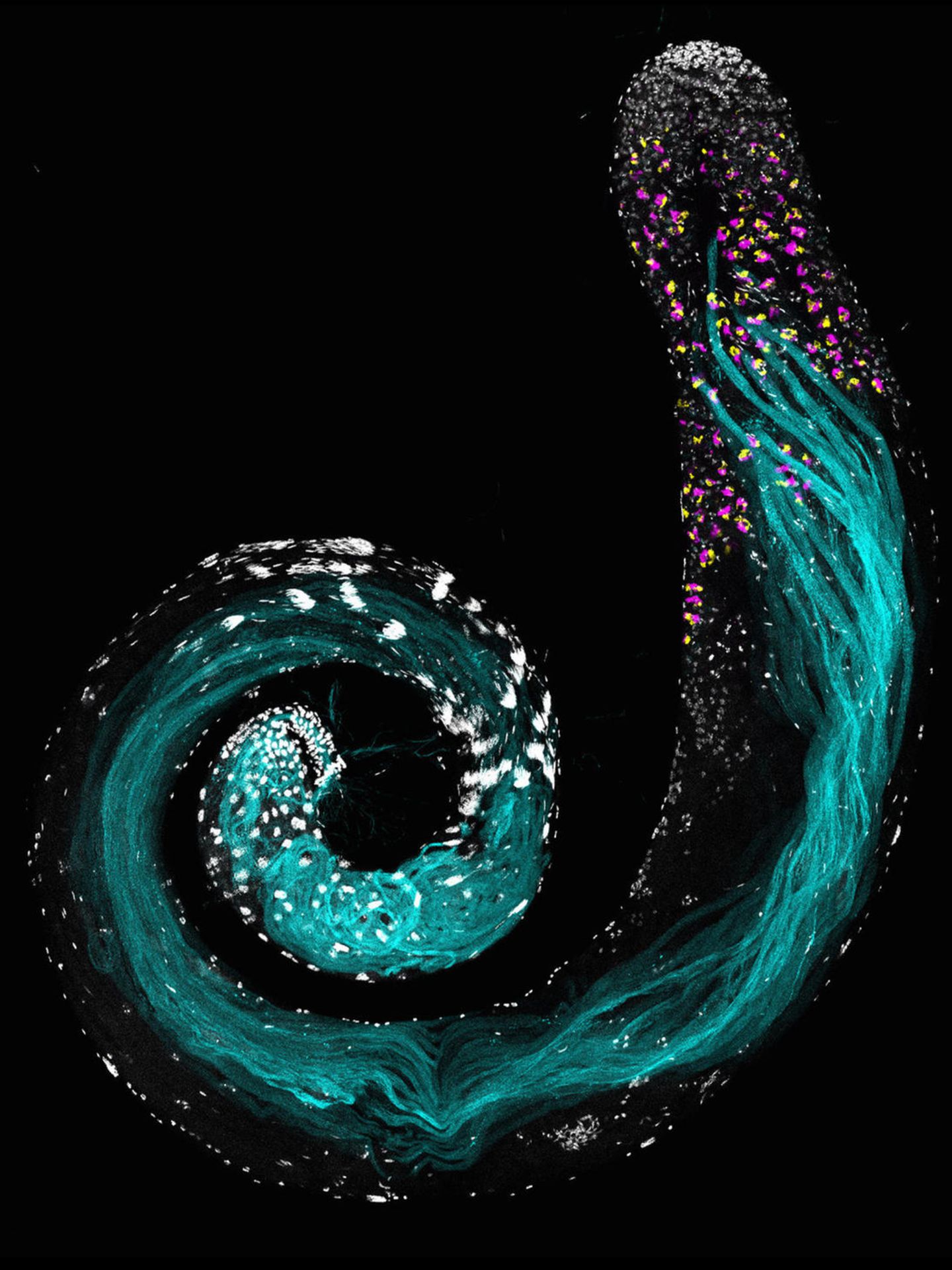 Ein Hoden von Drosophila melanogaster unter dem Mikroskop
