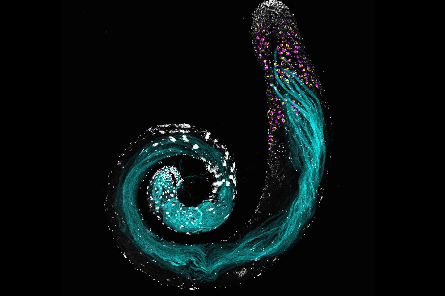 Ein Hoden von Drosophila melanogaster unter dem Mikroskop