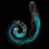 Ein Hoden von Drosophila melanogaster unter dem Mikroskop