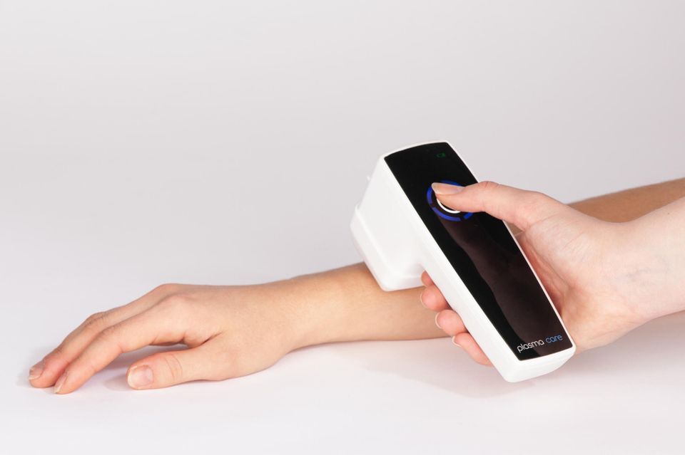 Plasma-Gerät wird auf der Haut eines Arms angewendet