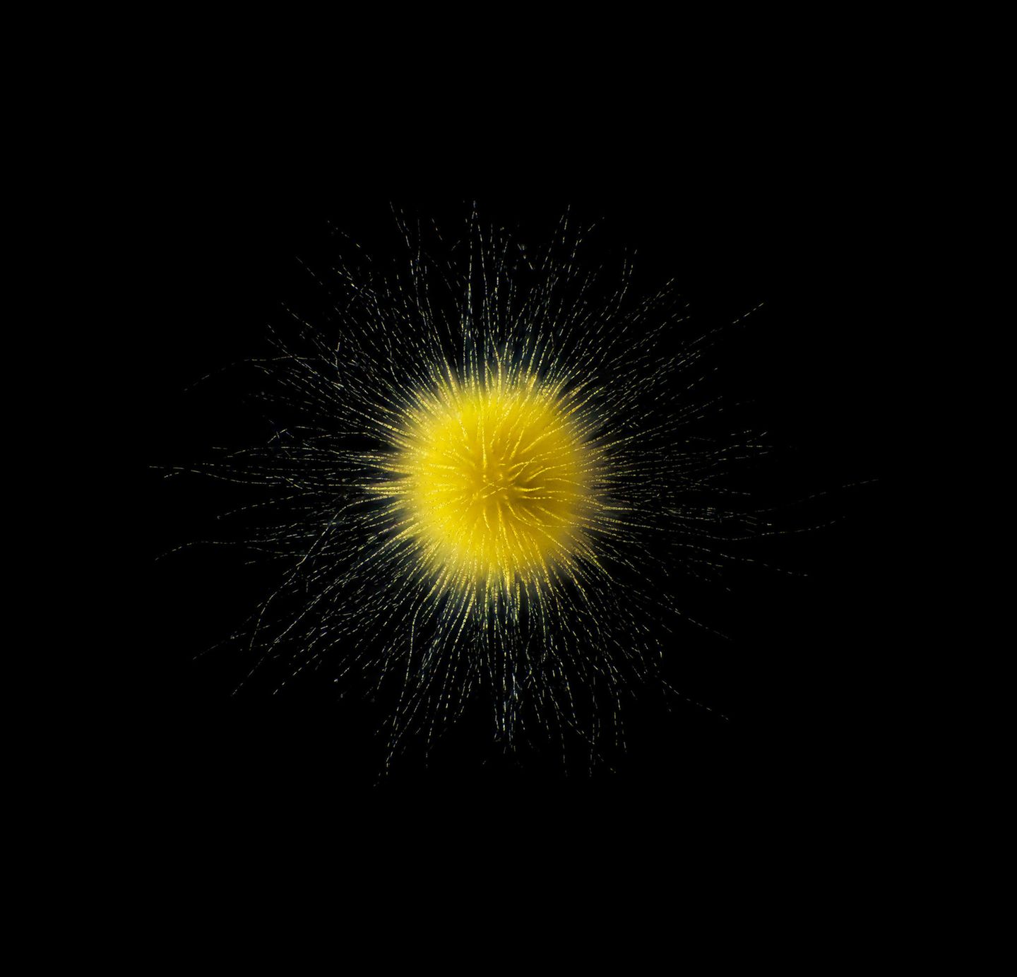 "Gloeotrichia sp.": Koloniebildende Cyanobakterien Planktonium