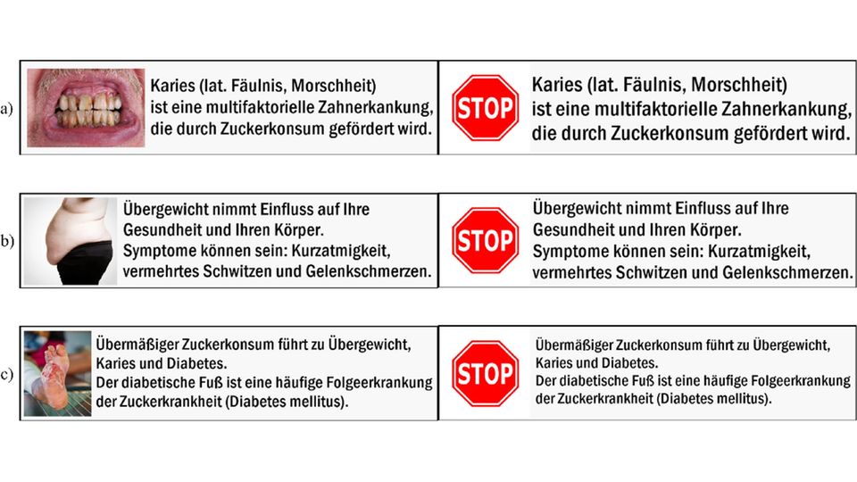 Warn-Labels vor zu hohem Zuckerkonsum  Warn-Labels vor zu hohem Zuckerkonsum
