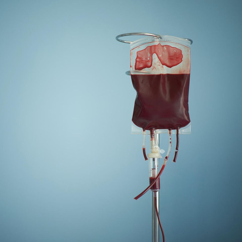 Blutkonserve an Tropf vor blauem Hintergrund Blutkonserve an Tropf vor blauem Hintergrund