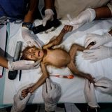 Affenjunges liegt auf einem Tisch umgeben von Händen in Handschuhen