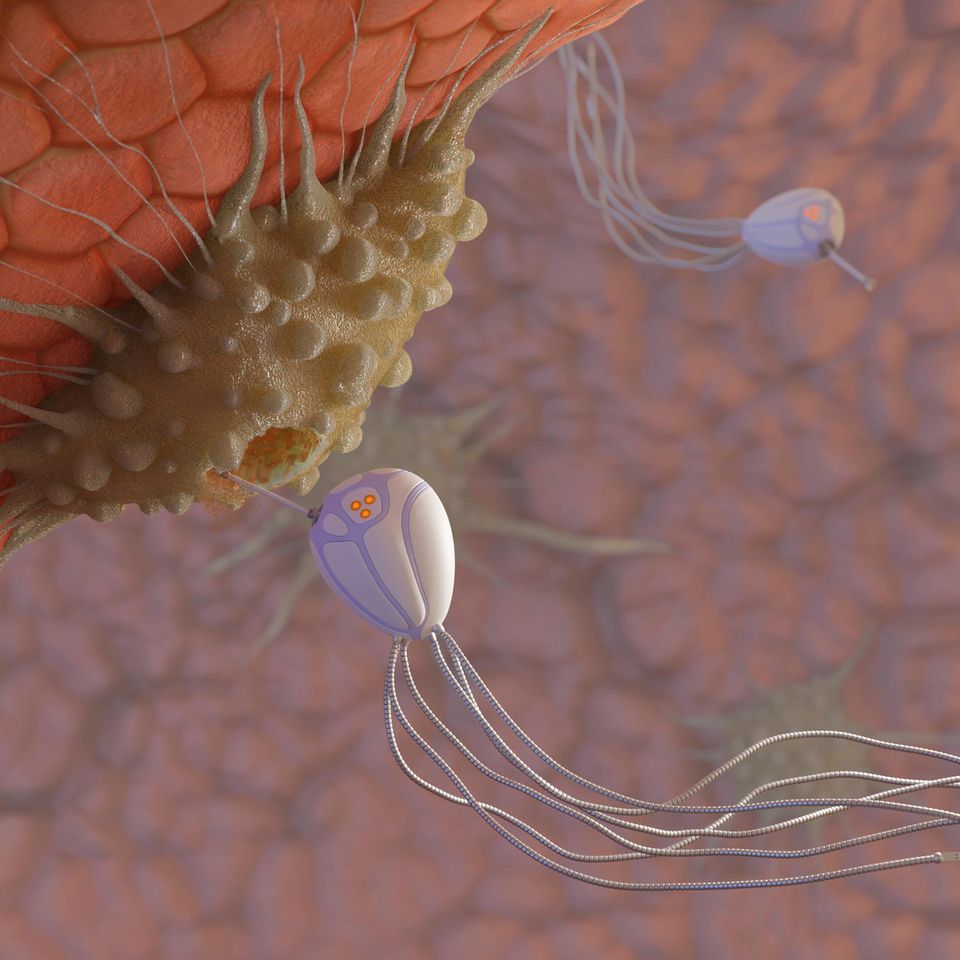 Die Illustration eines Nanoroboters an einer Krebszelle