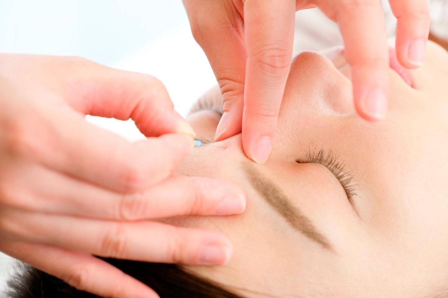 Frau setzt eine Akkupunkturnadel zwischen die Augen einer liegenden jungen Frau Frau setzt eine Akkupunkturnadel zwischen die Augen einer liegenden jungen Frau